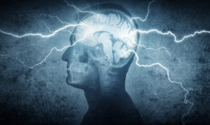 electroshock, electroconvulsive therapy, ect, brain damage